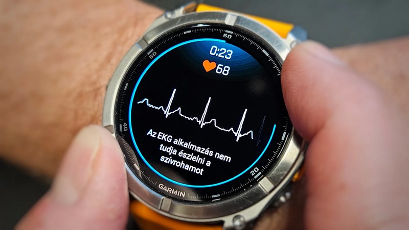 Garmin EKG swatch